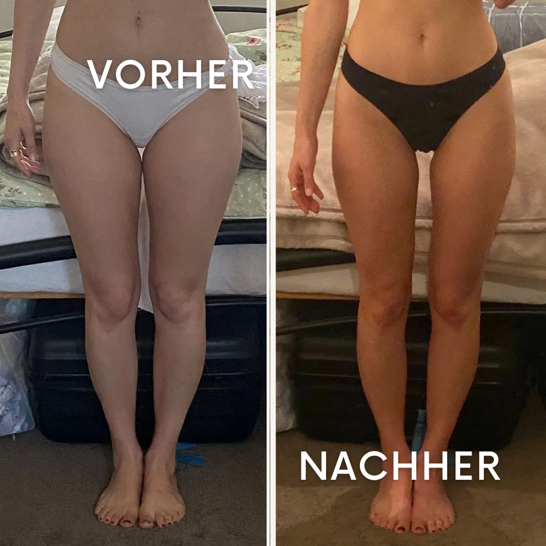 VeinEase: Freiheit von schweren Beinen