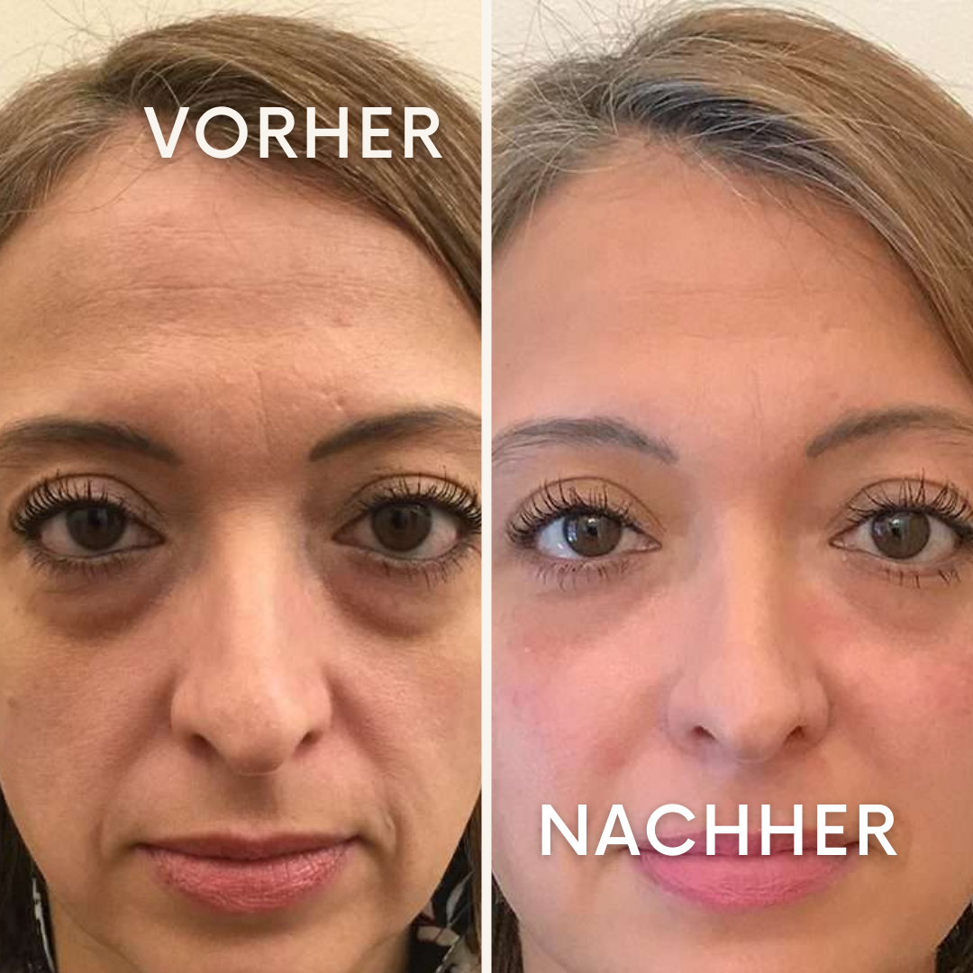 BlinkSpa: dein Wellness-Moment für die Augen